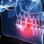 10 domowych sposobów na ból zęba