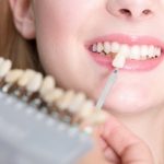 Wybielanie zębów – nie rób tego w domu!