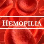 Hemofilia – co wiemy o tej chorobie?