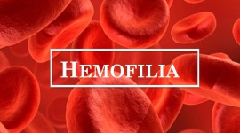 Hemofilia – co wiemy o tej chorobie?