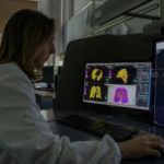 Synapse 3D ułatwia zarządzanie diagnostyką pacjentów podczas pandemii COVID19